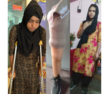 Shima's Journey to Recovery with Mastulaid’s Lifesaving Artificial Leg Support